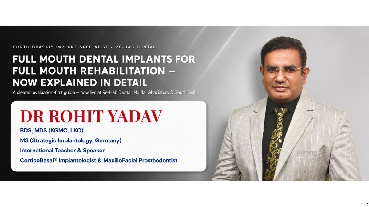 𝗙𝘂𝗹𝗹 𝗠𝗼𝘂𝘁𝗵 𝗗𝗲𝗻𝘁𝗮𝗹 𝗜𝗺𝗽𝗹𝗮𝗻𝘁𝘀 𝗳𝗼𝗿 𝗙𝘂𝗹𝗹 𝗠𝗼𝘂𝘁𝗵 𝗥𝗲𝗵𝗮𝗯𝗶𝗹𝗶𝘁𝗮𝘁𝗶𝗼𝗻 𝗡𝗼𝘄 𝗘𝘅𝗽𝗹𝗮𝗶𝗻𝗲𝗱 𝗶𝗻 𝗗𝗲𝘁𝗮𝗶𝗹 𝗯𝘆 Dr Rohit Yadav 𝗮𝘁 𝗥𝗲-𝗛𝗮𝗯 𝗗𝗲𝗻𝘁𝗮𝗹